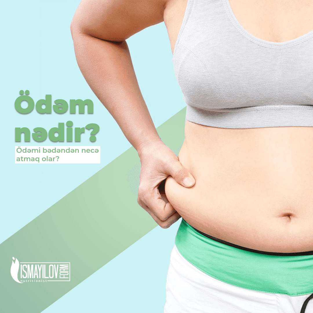 Ödəm nədir? Ödəmi bədəndən necə atmaq olar?